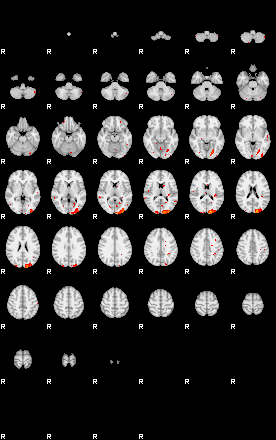 Patients 29070 152