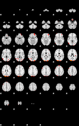 Patients 29173 190