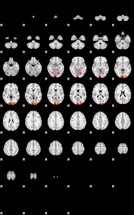 Patients 29175 38