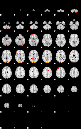 Patients 29292 11