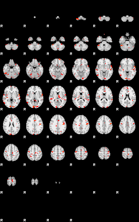 Patients 29555 24