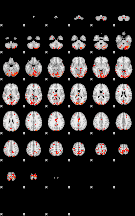 Patients 29615 159