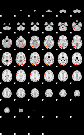 Patients 29177 142