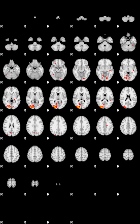 Patients 29555 12