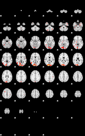 Patients 29027 121