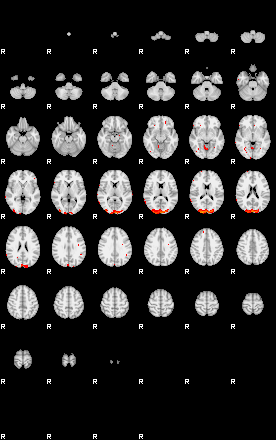 Patients 29430 7