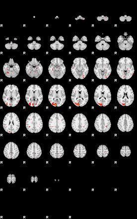 Patients 29516 148