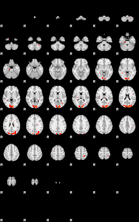 Patients 29740 170