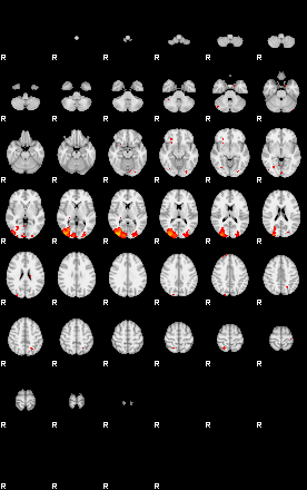 Patients 29164 123