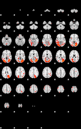 Patients 29208 117