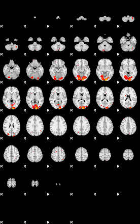 Patients 29223 13