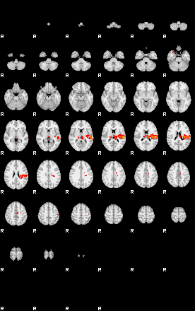 Patients 28818 82