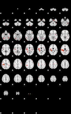 Patients 28995 94