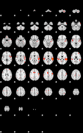 Patients 29013 163