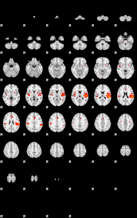 Patients 30187 80