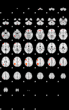 Patients 29203 166