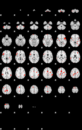 Patients 29203 171