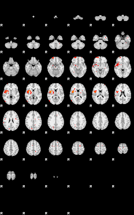 Patients 29511 154