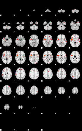 Patients 29587 20