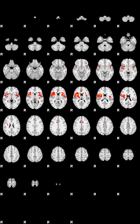 Patients 29180 138