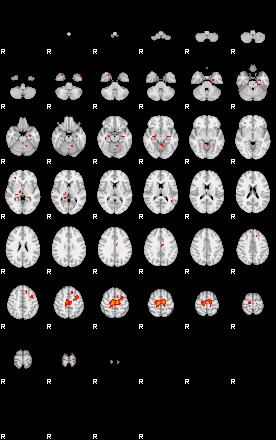 Patients 29057 11