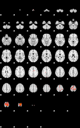 Patients 29067 99