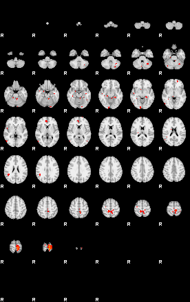 Patients 29164 188