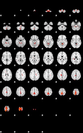 Patients 29189 132