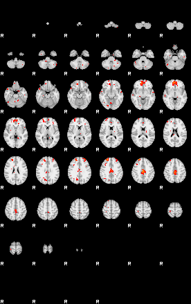 Patients 29188 23