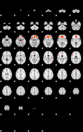 Patients 29412 23