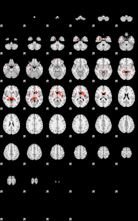 Patients 29671 159