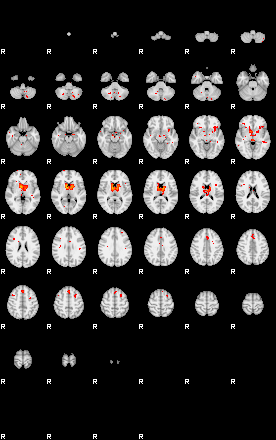 Patients 29200 190