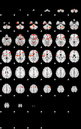 Patients 28799 124