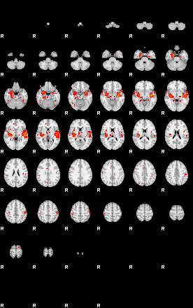 Patients 29161 104