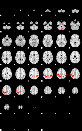 Patients 29173 74