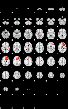 Patients 29013 189