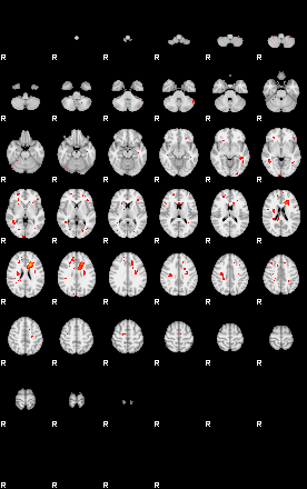 Patients 29015 170