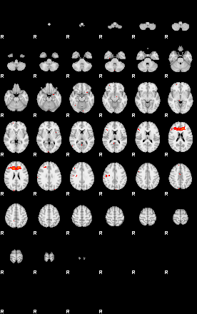 Patients 29017 152