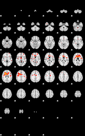 Patients 29100 187