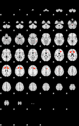 Patients 29798 200