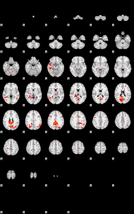 Patients 29208 93