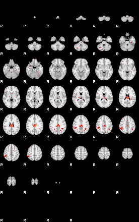 Patients 29495 120