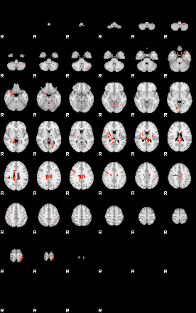 Patients 30019 160