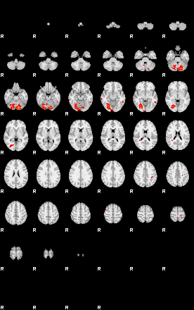 Patients 29165 76