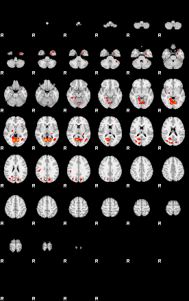 Patients 29057 96