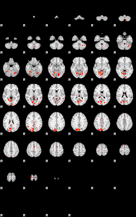 Patients 28942 12