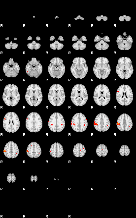 Patients 29166 150