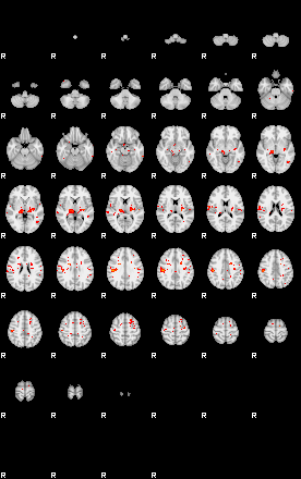 Patients 29623 6