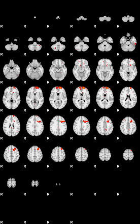 Patients 29150 92