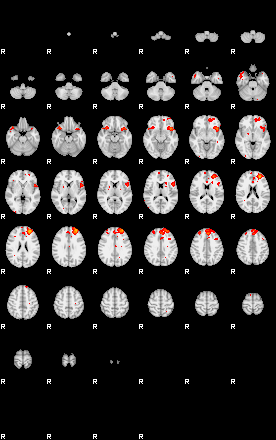 Patients 29165 138